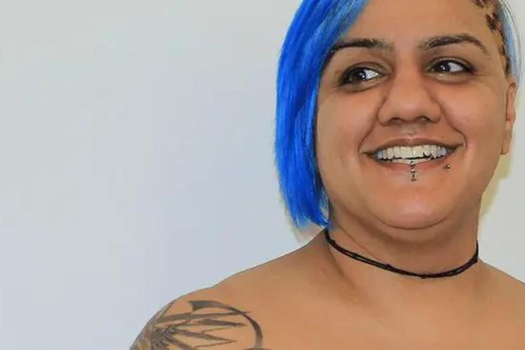 My PCOS Diary: Laser Hair Removal Experience at Skin Clinic