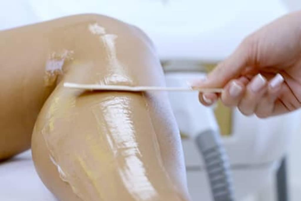 Why Spring is a Great Time to Begin Your Laser Hair Removal Journey