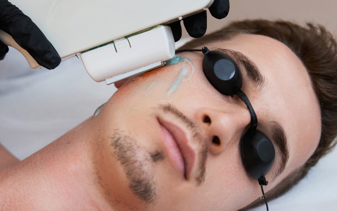 How Progen Aesthetics Clinic Ensures Pain-Free Laser Hair Removal in Bournemouth