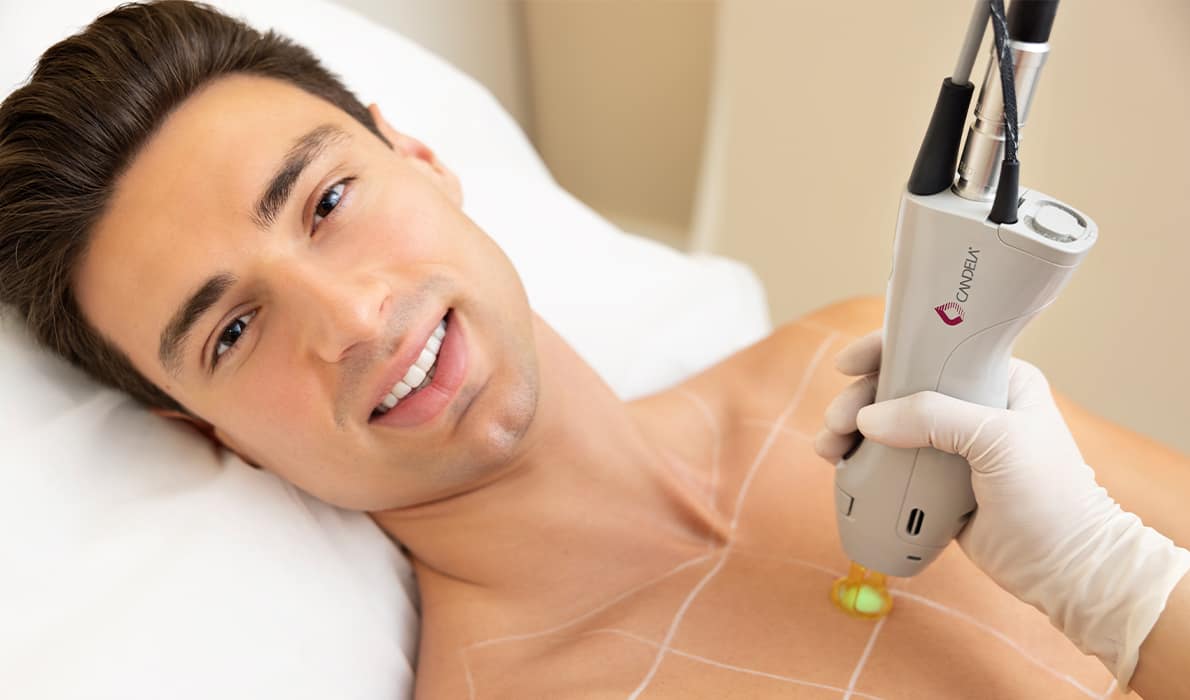 The Benefits of Candela Laser Hair Removal Treatment