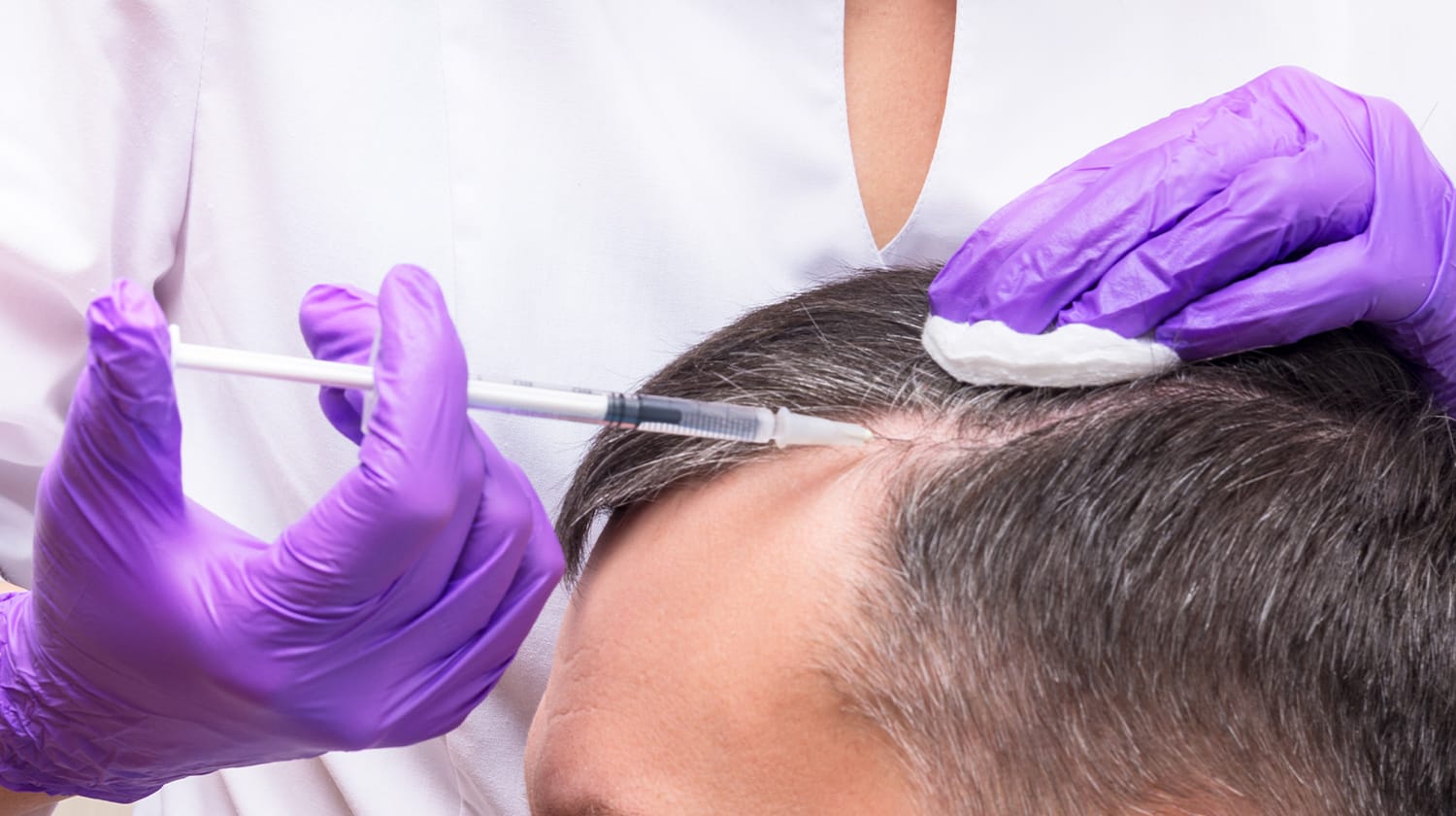 PRP Hair Treatment in Bournemouth: What to Expect
