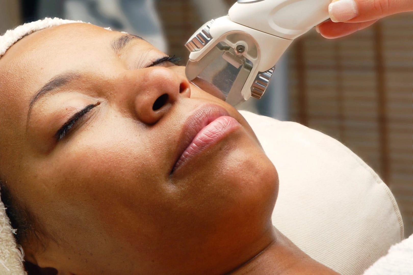 Laser Hair Removal for Black Skin: A Comprehensive Guide