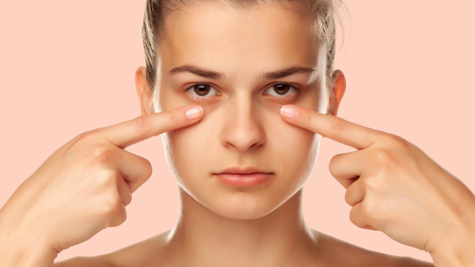 How to Get Rid of Dark Circles: Best Treatments and Remedies