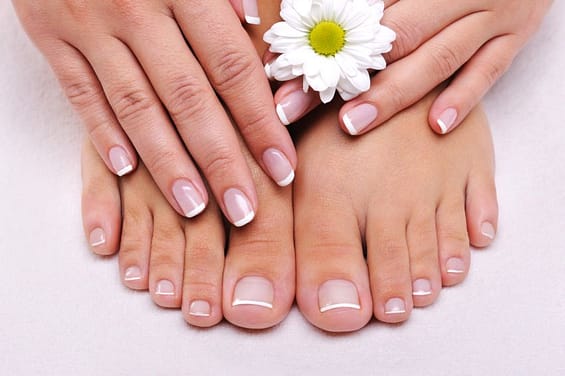 fungal nail after treatment with laser