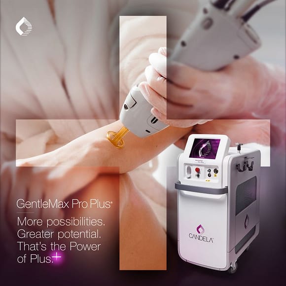 Explore the cutting-edge solution to fungal nails with our Candela laser treatment!