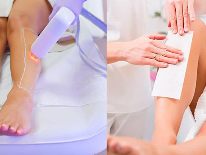 Comparing Laser Hair Removal to Traditional Hair Removal Methods