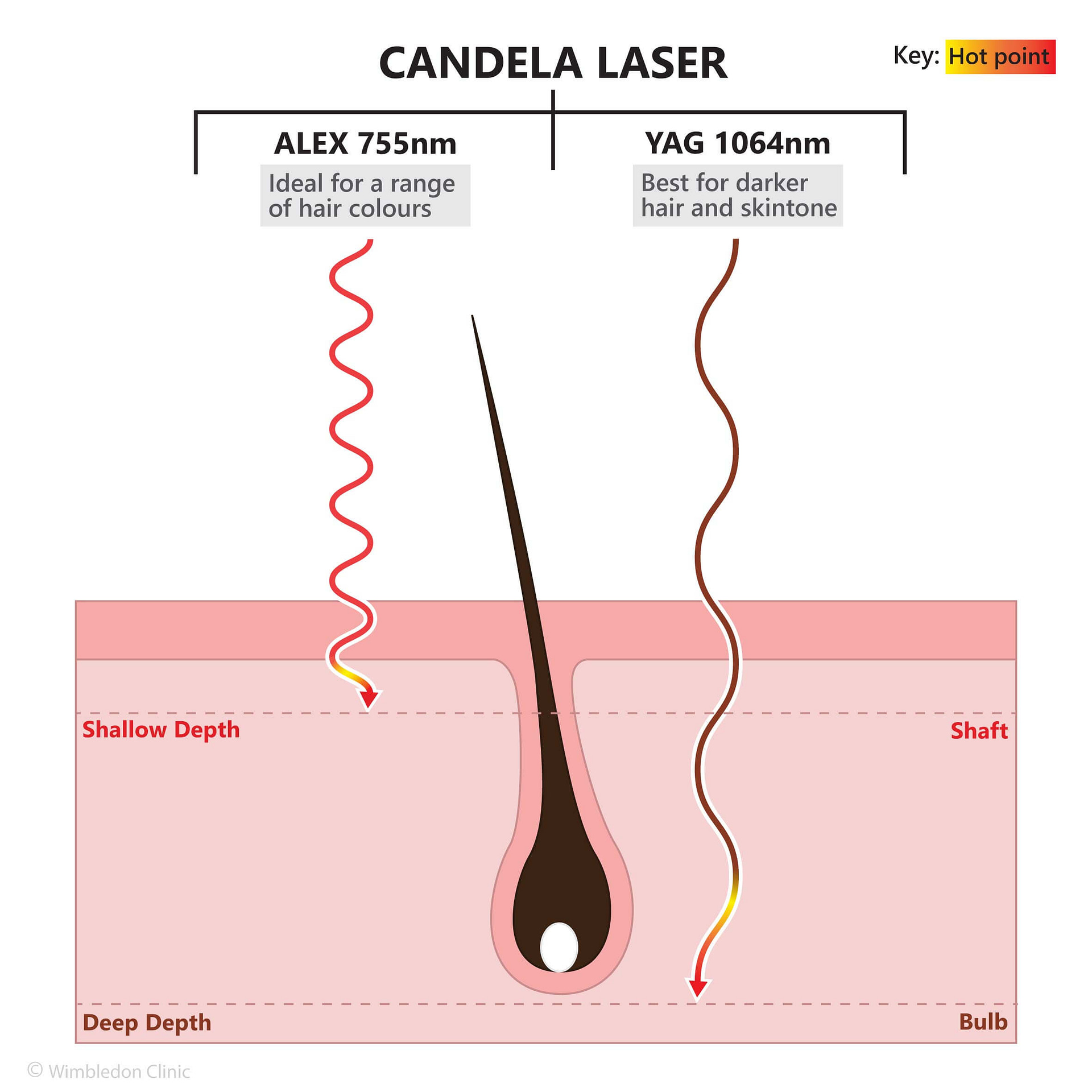 This advanced system features both Alexandrite and ND:YAG
lasers, providing effective hair removal for all skin types and tones. The Alexandrite laser targets lighter skin tones, while the ND:YAG
laser is ideal for darker skin tones. Together, they ensure comprehensive and permanent hair reduction, delivering smooth, hair-free skin with minimal discomfort. Experience the cutting-edge technology of the GentleMax Pro Plus and achieve superior results in hair removal.
